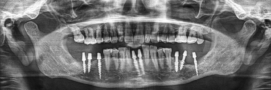 digital x-ray flowery branch