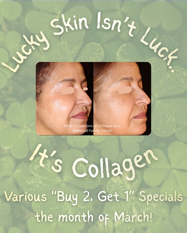 March Cartessa Promos